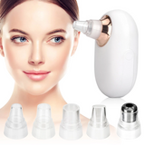 Portable Vacuum Blackhead Remover | Deep Pore Face Cleaner UK