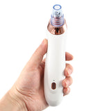 Electric Acne & Blackhead Remover | Skin Clearing Device UK