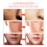 5 in 1 Facial Serum – Vitamin C, Niacinamide & Hyaluronic Acid