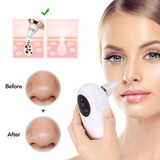 Portable Vacuum Blackhead Remover | Deep Pore Face Cleaner UK