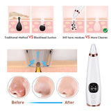 Microcrystalline Blackhead Removal Beauty Instrument | Skin Tool UK